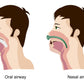 Complete Airway Emergency KIT #5