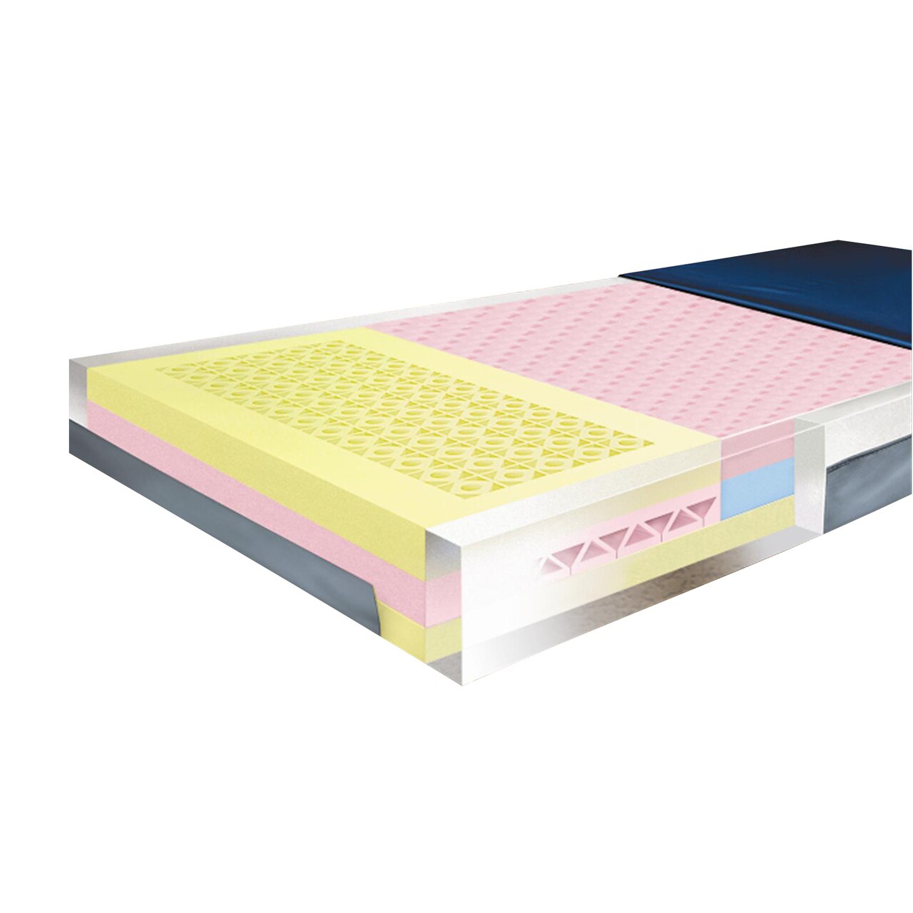 Mason Medical Multi-Ply Global Foam 4 Layer Pressure Redistribution Mattress, 76"